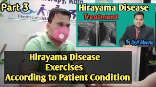 hirayama disease treatment and exercises  hirayama disease exercises  hirayama Exercise in hindi [upl. by Nnodnarb822]