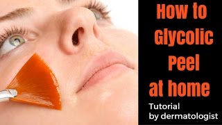 How to do Chemical Peel at Home How to do Chemical Peel Treatment at Home Chemical peel kaise karen [upl. by Del253]