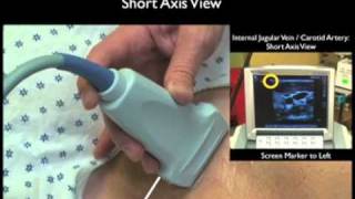 Ultrasound Guidance for Central Venous Access Part 1 [upl. by Sandi]