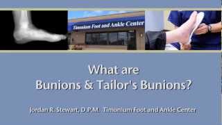 Bunions and Tailors Bunions and How To Treat Them [upl. by Llert310]