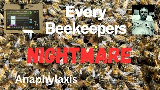 Beekeeping  Anaphylaxis bee sting [upl. by Asteria473]