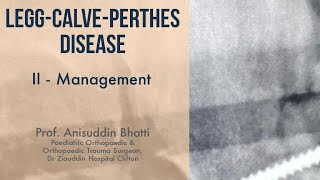 Legg  Calve  Perthes Disease  Management Principle In Depth Lecture by Prof Anisuddin Bhatti [upl. by Orrin95]