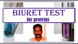 BIURET Test for Protein BIOCHEMISTRY CLASSES [upl. by Eceinhoj]