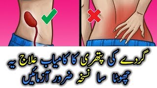 gurdy main pathri ka ilaj  kidney stone treatment urduhindi  Health Ki Dunya [upl. by Bradshaw]