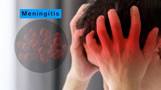 Mayo Clinic Minute  What new college students should know about bacterial meningitis [upl. by Kumler133]