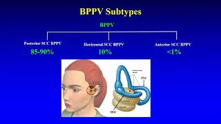 BPPV  Preliminary Insights [upl. by Drehcir]