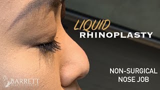 Liquid Rhinoplasty  Non Surgical Nose Job  Barrett Plastic Surgery  Beverly Hills [upl. by Suivatnom929]