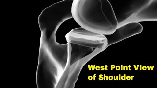 West point view of the shoulder [upl. by Naniac907]