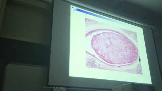 pathology practical thrombus [upl. by Anneyehc805]