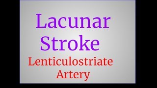 Lacunar Stroke [upl. by Lleoj]