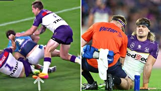 Ryan Papenhuyzen injury The fullback for the Melbourne Storm has an ankle problem [upl. by Aldo]