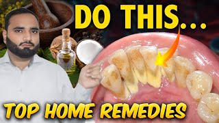 Top Remedies To Remove Dental Plaque TARTAR  dental plaque remedies  Dr Aqeel Maqsood [upl. by Ahsinut]