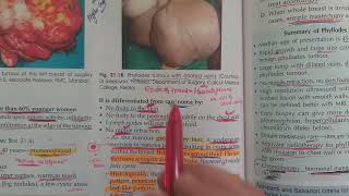 Phyllodes tumor  Cystosarcoma Phyllode in hindi [upl. by Margret]