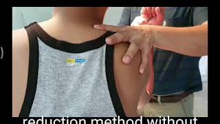 SHOULDER DISLOCATION amp REDUCTION METHOD [upl. by Enitsua]