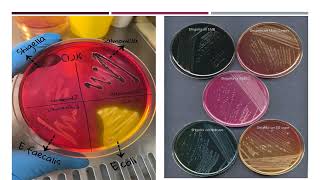 الكشف عن بكتريا الشيجلا Detection of Shigella bacteria [upl. by Maillw]