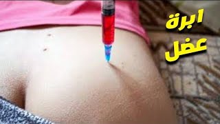 How to Give an IM Intramuscular injection in the Buttocks  Dorsogluteal hip Technique 👨‍⚕ [upl. by Candyce547]