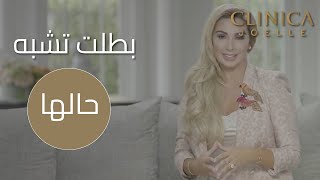 أكثر من سنتين لتغيير شكل بتول بشكل كلي [upl. by Oicor]