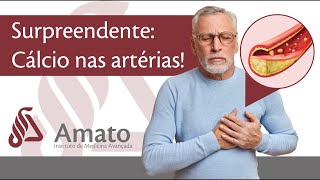 Surpreendente Verdade Sobre a Calcificação nas Artérias a Aterosclerose [upl. by Zennie]