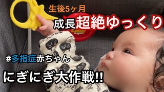 【4pマイナス症候群】ピナちゃんのにぎにぎ大作戦‼︎【多指症赤ちゃん】 [upl. by Rudolph]