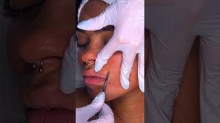 The Softest Dermaplaning ASMR 😱🩵 [upl. by Burney]