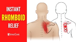 How to Fix Rhomboid Pain FOR GOOD [upl. by Puett]