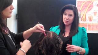 Hair Loss Natural Treatments with Microneedle Therapy [upl. by Decato]