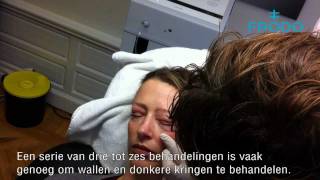 Behandeling Wallen en donkere kringen rond de ogen verbeteren met Carboxytherapie [upl. by Alicirp371]