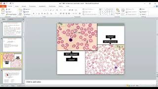 Practical Hematologylab 7 and 8 RBCs Indices and Retic Count [upl. by Halehs]