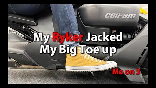 My Ryker Jacked My Big Toe Up [upl. by Wight]