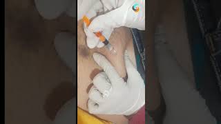 Subcutaneous injection on belly swastik injection nursing [upl. by Lotus]