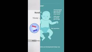 chromosomal disorders sunidhhiii7705 [upl. by Petra]