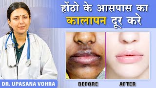 How to Remove Pigmentation Around the Mouth Upasana Ki Duniya [upl. by Adnahsam889]