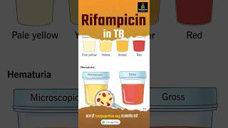 What is Rifampicin  Rifampicin in TB rifampicin nursing testpaperlivenursing shortvideo aiims [upl. by Erbe]