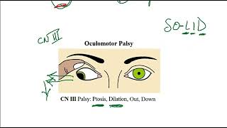 Video 220 Ocular Muscle Innervation amp Cranial Nerve Lesions Anatomy Function amp Clinical Correlates [upl. by Gabriellia]