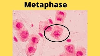 What happens during metaphase [upl. by Milda]