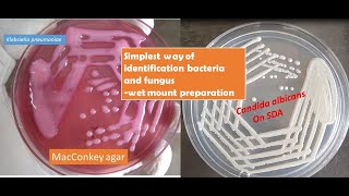 A very simple Saline wet mount techniue help you to identify yeast cells of candida from bacteria [upl. by Olegnad]