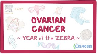 Ovarian cancer Year of the Zebra [upl. by Nivlad]