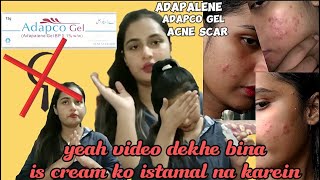 Dont use without watch this video  Adapco gel  adapalene gel 01  adapalene benefit ampside effect [upl. by Audri]