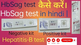 HbSag test कैसे करें। HbSag test in hindi  HepatitisB test [upl. by Mckinney]