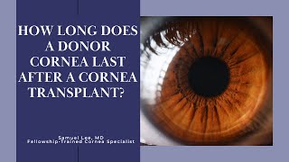 How long does a donor cornea last [upl. by Tarsuss341]