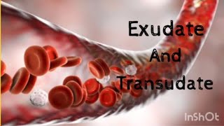 Exudate and Transudate  Basic Pathology [upl. by Ellan855]