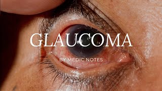 What is Glaucoma  ग्लूकोमा क्या है  Hindi [upl. by Ddene224]