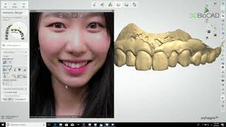 3DBioCAD  Digital Smile Design Pt1 Quick 3D Smile Design [upl. by Ian]