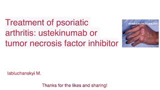 Treatment of psoriatic arthritis ustekinumab or tumor necrosis factor inhibitor [upl. by Ayahsey]