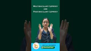 Paucibacillary Leprosy 😲 shorts shortvideo education [upl. by Ennoval484]