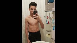 Pectus Carinatum Bodybuilding Transformation 2 Year Body Metamorphosis [upl. by Rogers485]