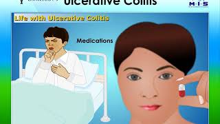 Lybrate  Dt Uc Program What is Ulcerative Colitis [upl. by Ellis804]