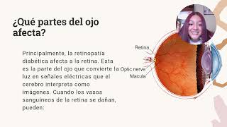 video retinopatía diabética [upl. by Rad466]