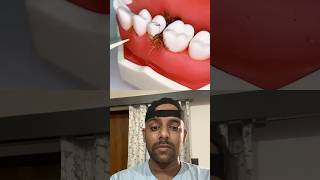 Teeth treatment shorts youtube facts reaction trendingshorts viralshorts [upl. by Morgan801]