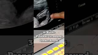 30 Weeks Prenatal Ultrasound Gender Reveal [upl. by Siegel]